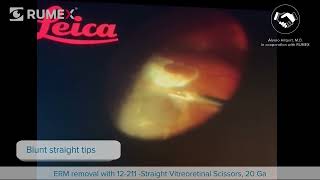 Surgery Live! ERM removal by Álvaro Hilgert, M.D. with Straight Vitreoretinal Scissors, 12-211