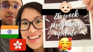 20 Week Pregnancy Update | Anatomy Scan & Heart Beat | Chinese Indian Couple in UK