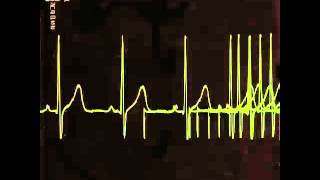 Usurp Synapse - Extra Guys Screaming