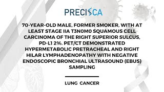 Expert Cancer Panel: Stage IIA superior sulcus tumor (PD-L1 2%) w/ PET-avid LNs negative on EBUS