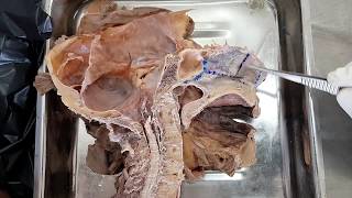 Nose Dissection |  Parts | Relations | Applied Anatomy