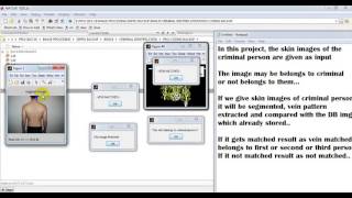 Criminal Identification Using Skin and Vein Pattern matlab||final year projects consultant bangalore