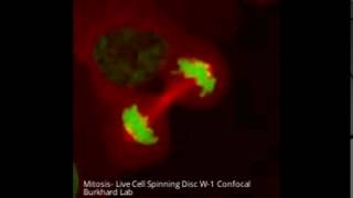 Spinning Disc- Live Cell Mitosis- Burkhard Lab