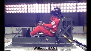 HANS Demonstration 🔥 - Head And Neck Support 👍🏻🤯