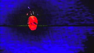 HARASSOR - STRANGULATED