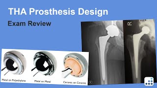 THA Prosthesis Design Exam Review - Harry Rubash, MD