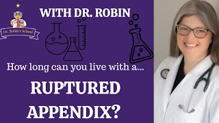 How long can you live with a RUPTURED APPENDIX?