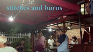 stitches and burns | ortega’s band cover 2020