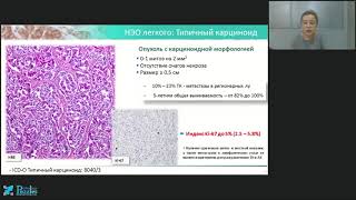 Диагностика нейроэндокринных опухолей лёгких
