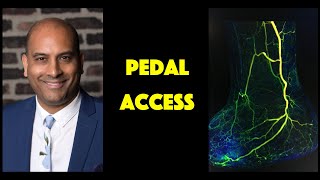 Let's Talk Pedal Access!
