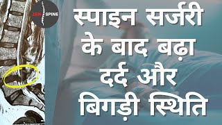 स्पाइन सर्जरी के बाद खराब हालत और दर्द: जानिए इनकी कहानी |