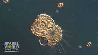 Amoeba and Heliozoan | 2017 Nikon Small World