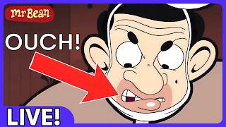 🔴 LIVE! TERRIBLE TOOTHACHE! 🦷😬🤣| Watch The Best Mr Bean Episodes Now! 🔴