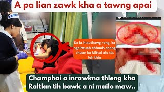 Champhai a inrawkna thleng kha Raltlan anih ngei rin ani/An suam na in a sawi/Fimkhur a van ngai em.