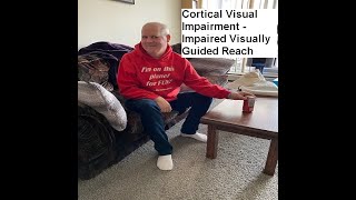 Cortical Visual Impairment (CVI) - Impaired Visually Guided Reach