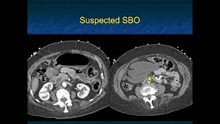 You Make the Call! Freestyle Radiology Quiz #21