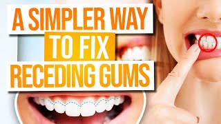 A Simpler Way to Fix Receding Gums