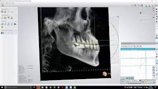 Tutorial Allineamento 2D 3D
