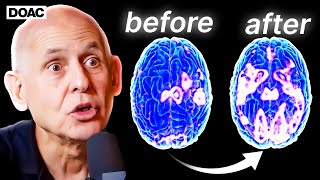 You're Not Stuck With The Brain You Have...You CAN Change It! | Dr Daniel Amen