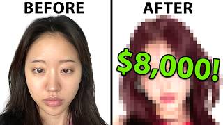 Plastic Surgeon Reacts To $8,000 EXTREME Korean Glow Up