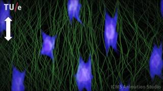 Collagen remodeling at the micro level
