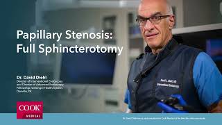 Indications for Sphincterotomy