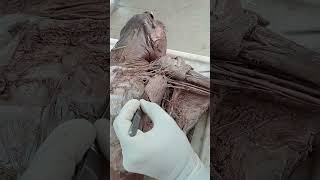 Axillary artery and Pectoral region muscles.