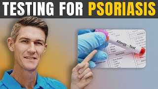 What Testing to get for Psoriasis | How to know why you have Psoriasis
