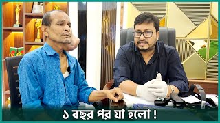 ছোট্ট একটি টিউমার ১ বছর পর যা হলো | Parotidectomy | Dr. Bashudeb Kumar Saha