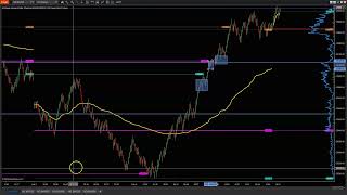 Trade Breakdown 2-2-2026 Trade of the Day