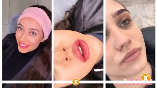 Vanessa Andrade explica o que é a revitalização labial