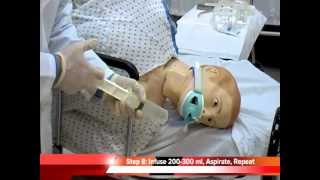 Gastric Lavage