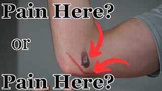 Golfer's Elbow or Cubital Tunnel Syndrome?