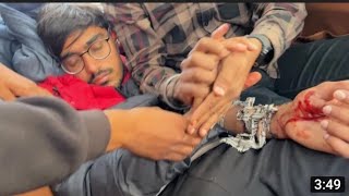 Amit bhai  ko snack me Kat liya halat  gambhir