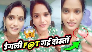 So Sad 😢 Rubi Kumari's finger got burnt 😰 | Ruby Kumari VERY SAD | Shivani Kumari Official