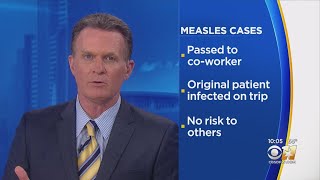 Dallas County Health And Human Services Confirms First Measles Case In Dallas Since 2017