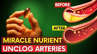 Just #1 INGREDIENT Opens Clogged Arteries and Prevent HEART Attack