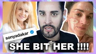 The aesthetician that burnt her clients face! UPDATE! SHES CRAZY!!!