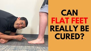 Can Flat Feet Really Be Cured? Everything You Need To Know