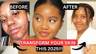HOW I TRANSFORMED MY SKIN | PRODUCTS & TIPS THAT WORK. Practical Tips