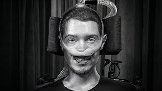 A vida com Síndrome de Duchenne - Lucas