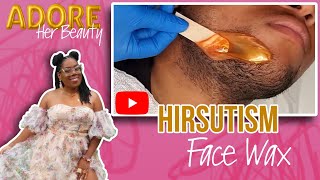 Into The Archives: Hirsutism Wax FIRST TIME!