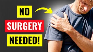 How to Heal a Rotator Cuff Tear Without Surgery