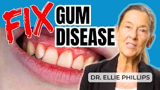 The ONE Strategy For Curing Gum Disease & Cavities