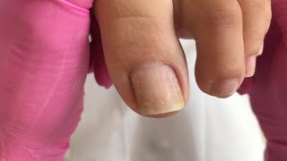 Unhas dos pés live 111219