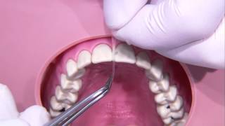 Conservative dentistry / Restoration of anterior tooth - Part 1