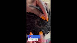 ASMR Fast and Aggressive Dandruff Scratching