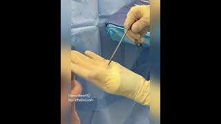 Elbow Arthroscopy in one of the greatest UFC Fighters. Every detail matters. #Arthrex JumpStart