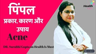 पिंपल के प्रकार, कारण और उपाय | Acne - types, causes & treatment - Dr. Surabhi Gupta