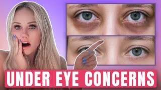 Looking Tired? Ask a Doctor! FREE Consultation - Live Q&A